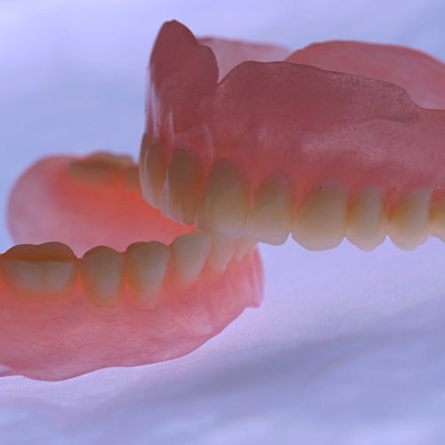 Regain Confidence with Custom-Made Removable Dentures